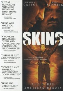 Skins