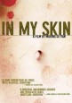 In My Skin