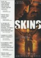 Skins